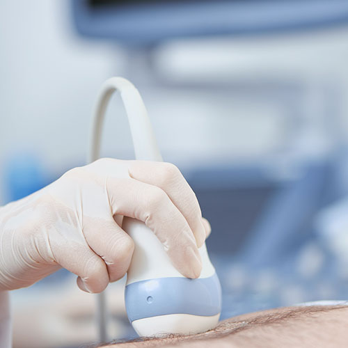 skola-ultrazvuka-kursevi-abdomen